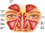 sinus-infection