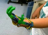 prosthetic-hand