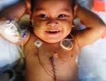 baby-five-organ-transplant