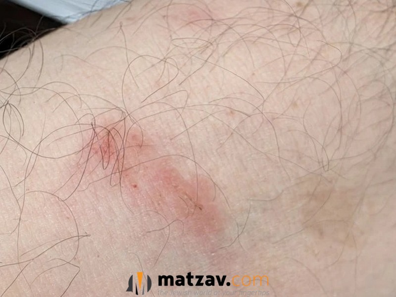 ‘Baby Killers’: Yarmulka-Wearing Jewish Realtor Brutally Attacked in Toronto in...